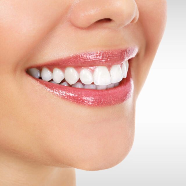 https://qsmiledental.com/wp-content/uploads/2024/05/CAVITY-4-8-640x640.jpeg