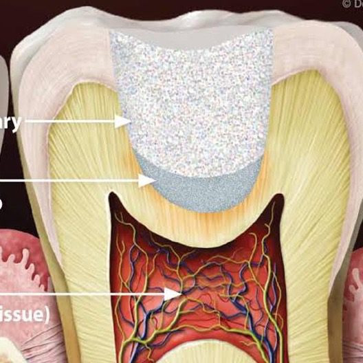 https://qsmiledental.com/wp-content/uploads/2024/05/Pulp-capping-.jpg