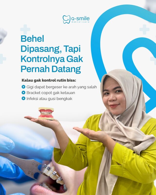 Pakai Behel? Jangan Malas Kontrol Jika Ingin Hasil Maksimal!