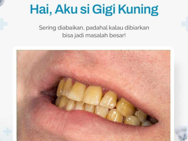 Gigi Kuning Bikin Ilfeel? Kenali Penyebab & Cara Mengatasinya!