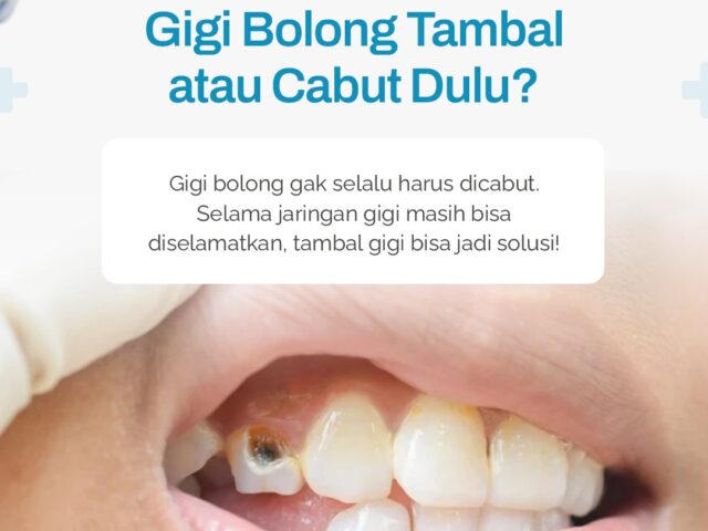 Gigi Berlubang: Kapan Harus Ditambal, Kapan Perlu Dicabut?