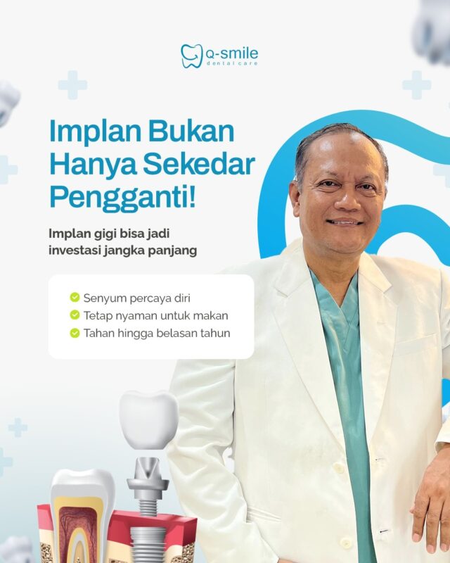 Manfaat Implan Gigi Jangka Panjang